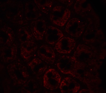 LAMP-1 Antibody