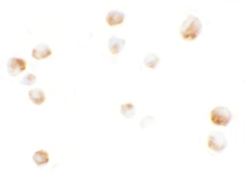 KPNA5 Antibody