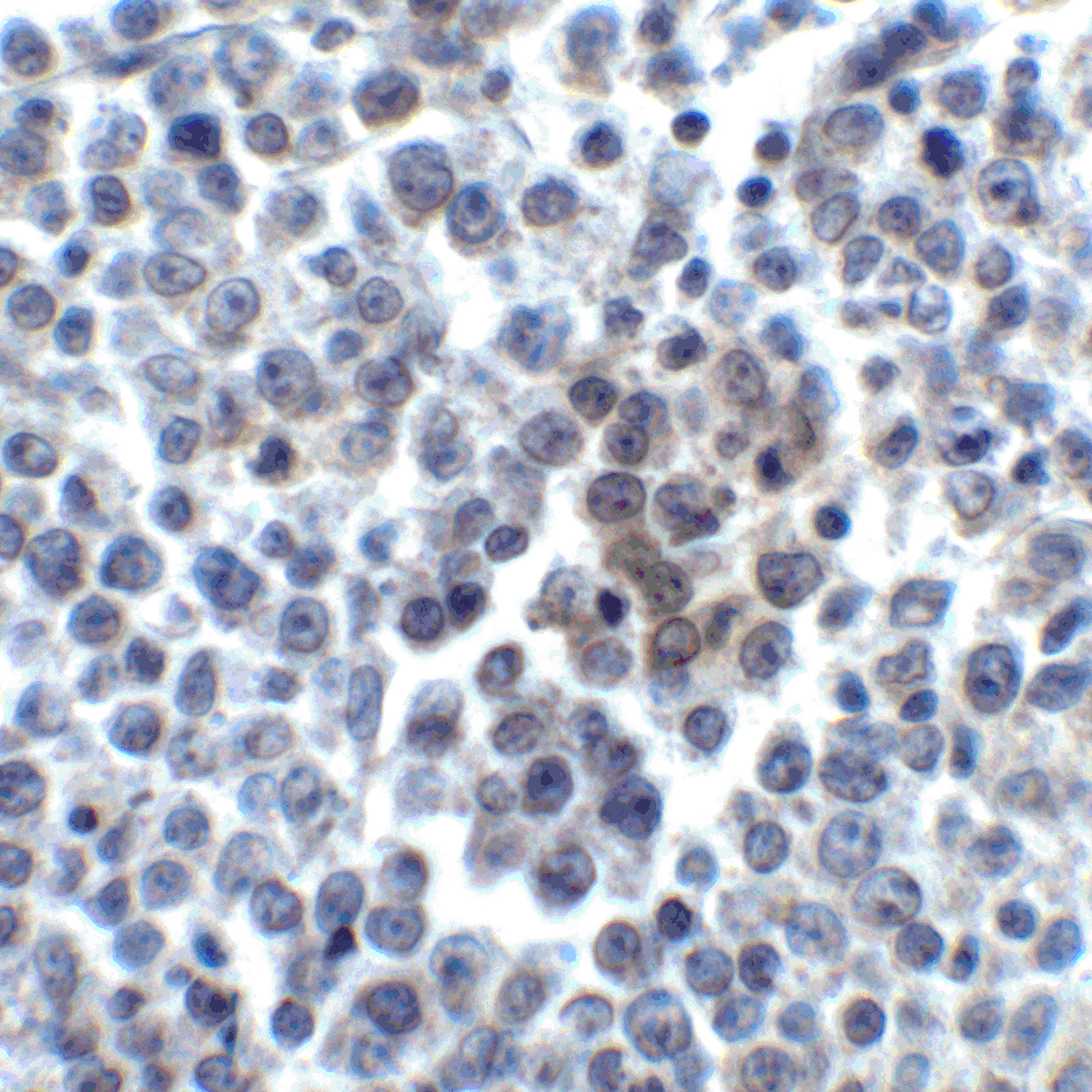 LIGHT Antibody [8D4]