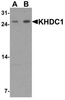 KHDC1 Antibody