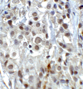 LSD1 Antibody