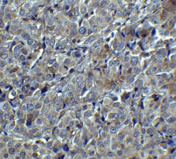 MAGEA4 Antibody