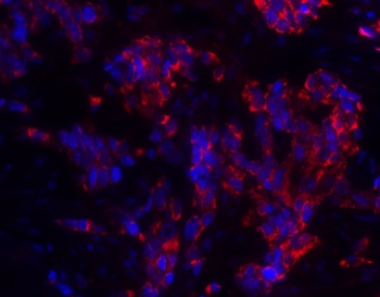 MAGEA4 Antibody