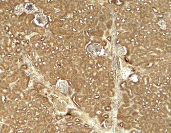 JAK2 Antibody