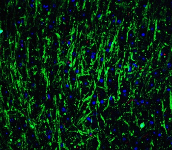 MSI2 Antibody
