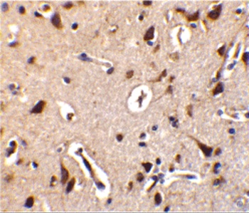 ILPIP Antibody