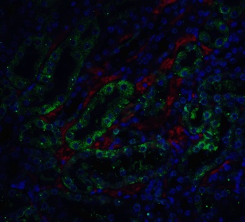 ICAD Antibody