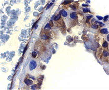 ICAD Antibody