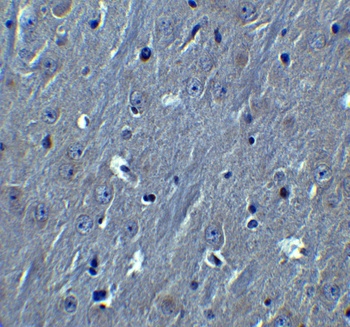 HOOK3 Antibody