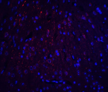 HOOK3 Antibody
