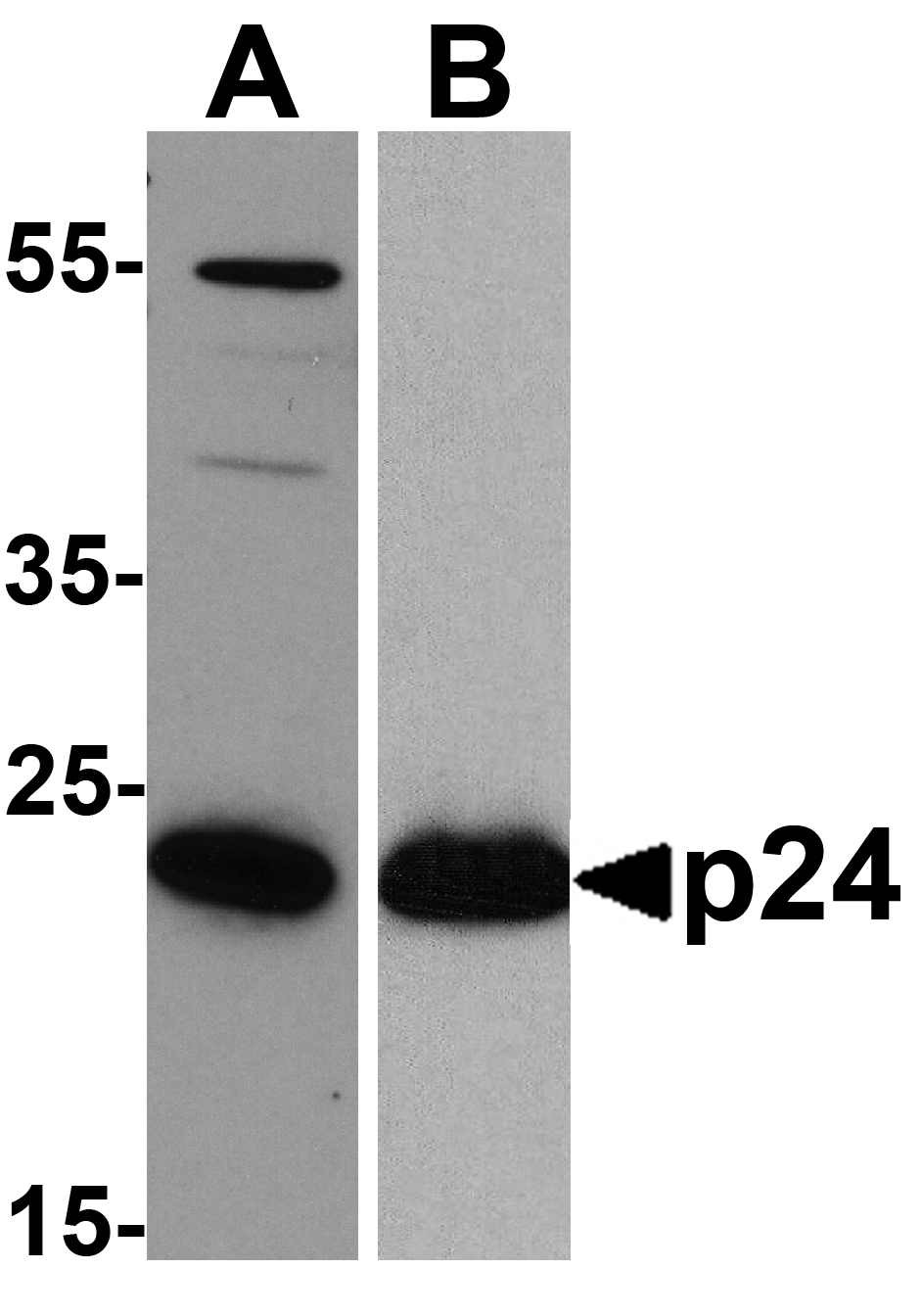 HIV-1 p24 Antibody [7F4]