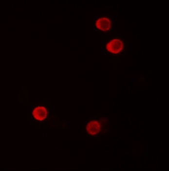 FHIT Antibody