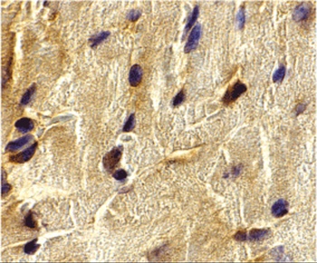 ECSIT Antibody