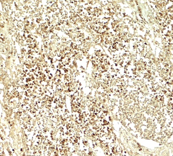 E2F3 Antibody