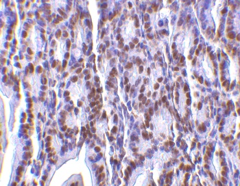 PHAP I Antibody