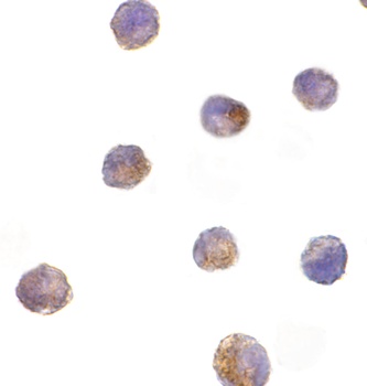 DFF40 Antibody