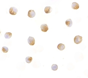 DFF40 Antibody