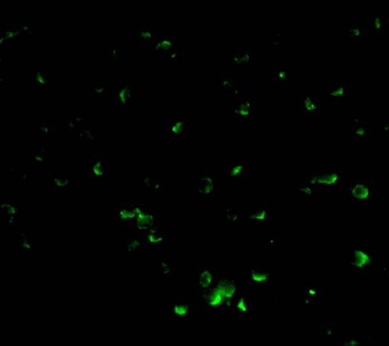 DFF40 Antibody