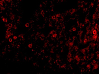 PKR Antibody