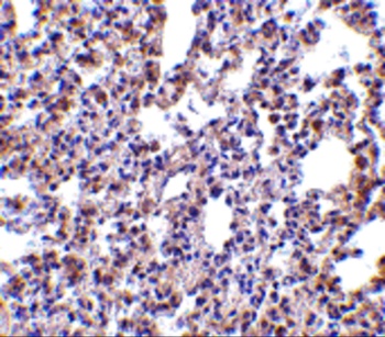 PKR Antibody