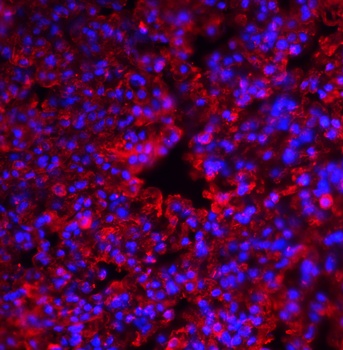 PKR Antibody