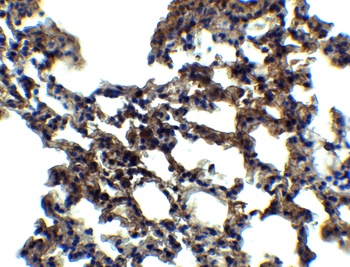 PKR Antibody