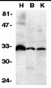 DcR3 Antibody