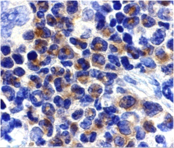 DAPK2 Antibody