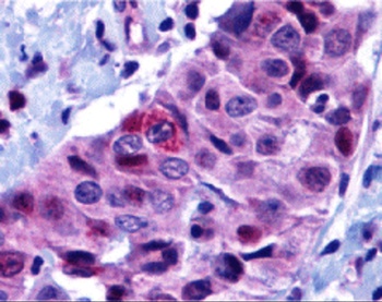 PUMA Antibody
