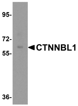 CTTNBL1 Antibody
