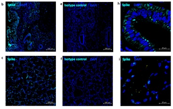 SARS-CoV-2 (COVID-19) Spike Antibody