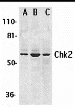 Chk2 Antibody