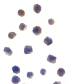 Chk2 Antibody