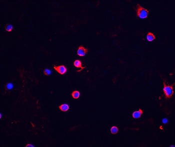 Chk2 Antibody