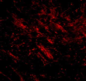 CDIP Antibody