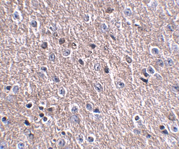 CDIP Antibody