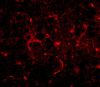 CDIP Antibody