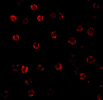 Caspase-1 Antibody