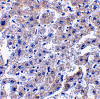 Caspase-14 Antibody