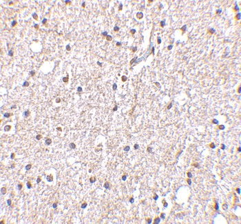 BRSK2 Antibody