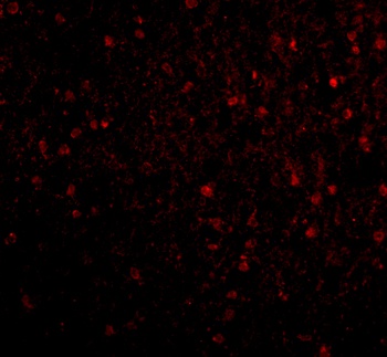BRSK2 Antibody