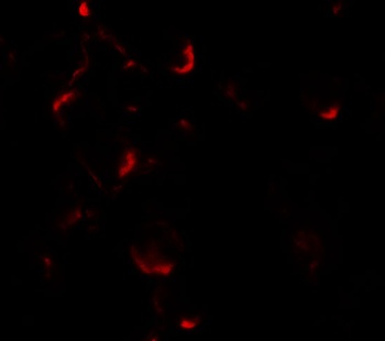 Bim EL Antibody