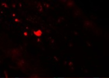 TFF3 Antibody