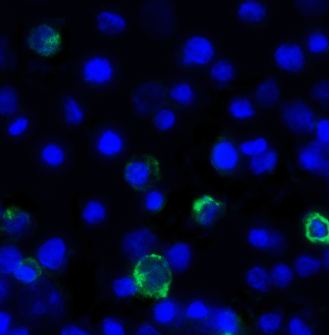 TIGIT Antibody [10B1]