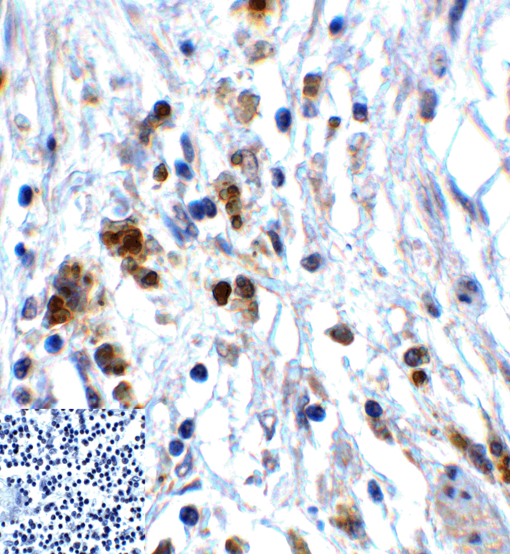 TIGIT Antibody [10B1]