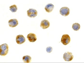 Beclin-1 Antibody