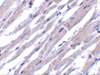 Bcl-rambo Antibody