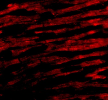 Bcl-rambo Antibody
