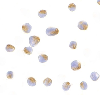 Bcl-B Antibody