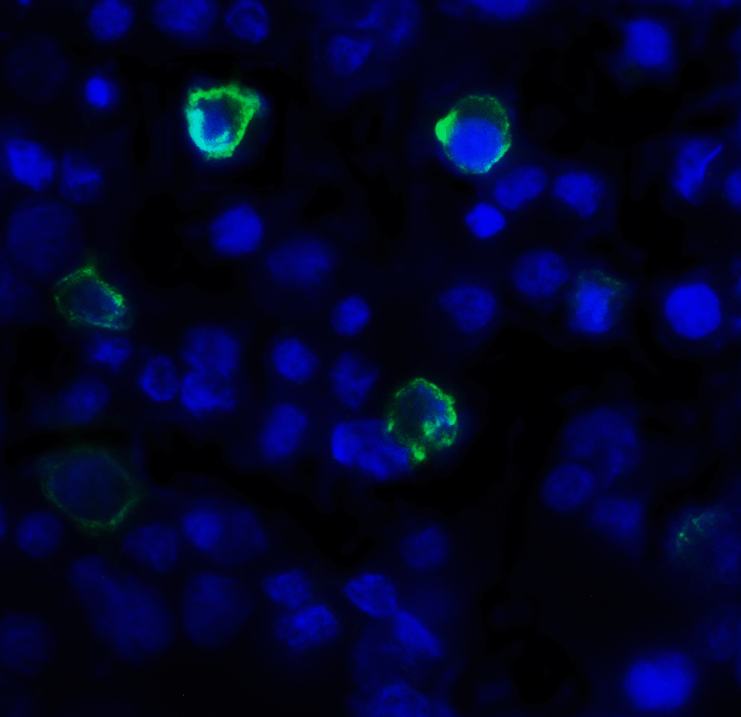 TIGIT Antibody [3B5]